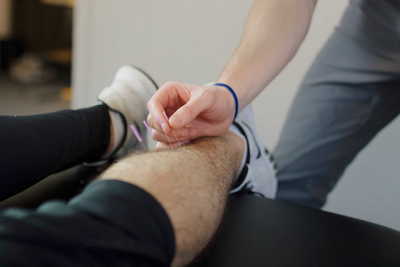 Dry needling 